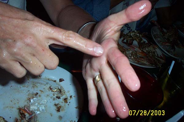 Candy's Injury