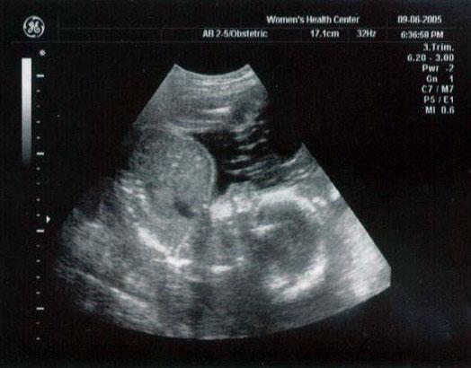 24 week ultrasound ~ All scrunched up in there!