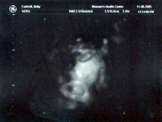 Baby Cantrell's Ultrasound Gallery ~ *NEW* pictures added November 10, 2005!